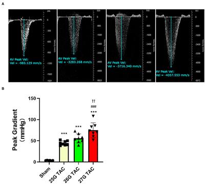 Distinct Phenotypes Induced by Different Degrees of Transverse Aortic Constriction in C57BL/6N Mice